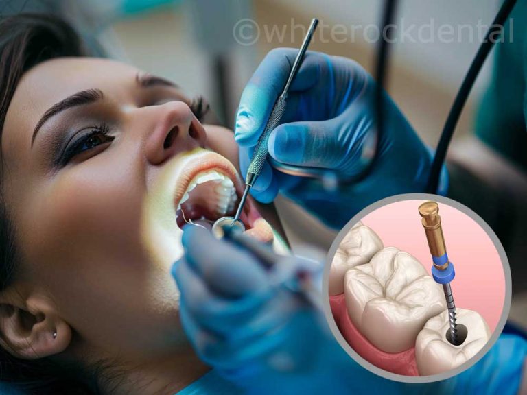Endodontics