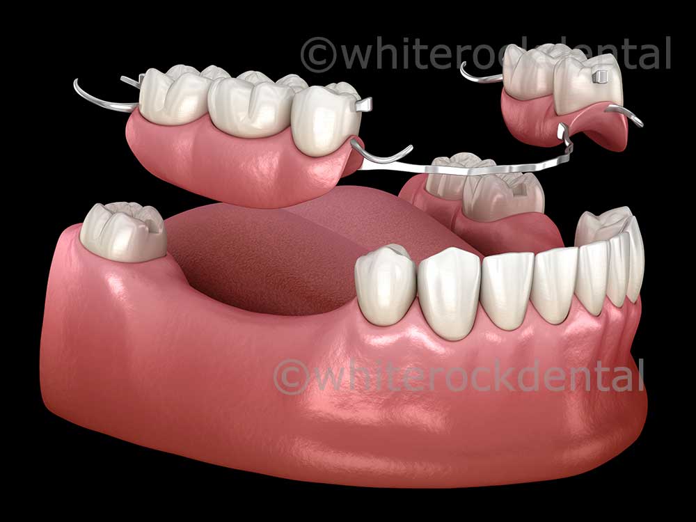 Prosthodontics