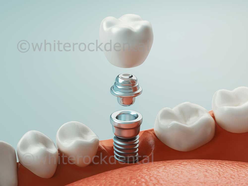Periodontics