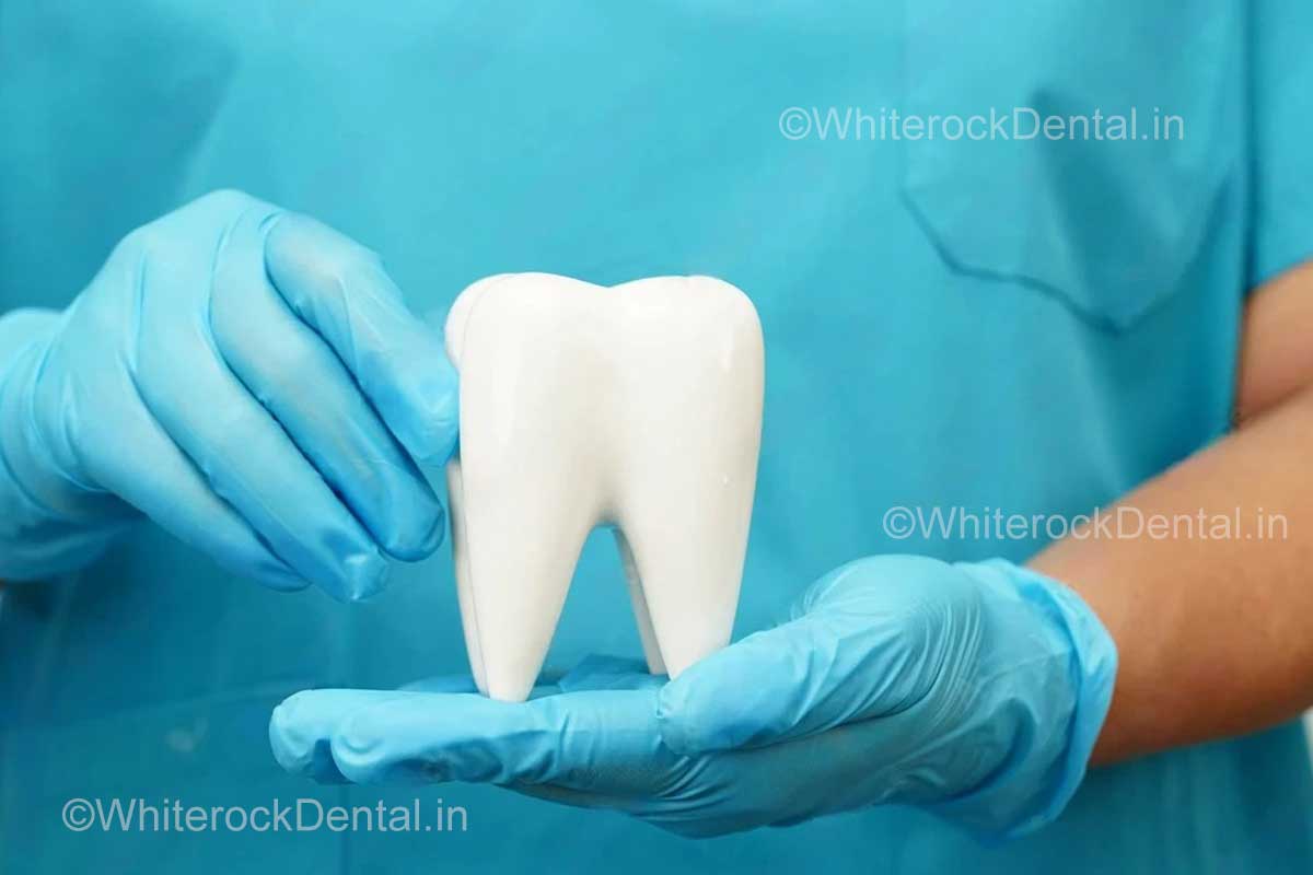 Root Canal + Crown: Is the Extra Expense Really Worth It? - Whiterock ...