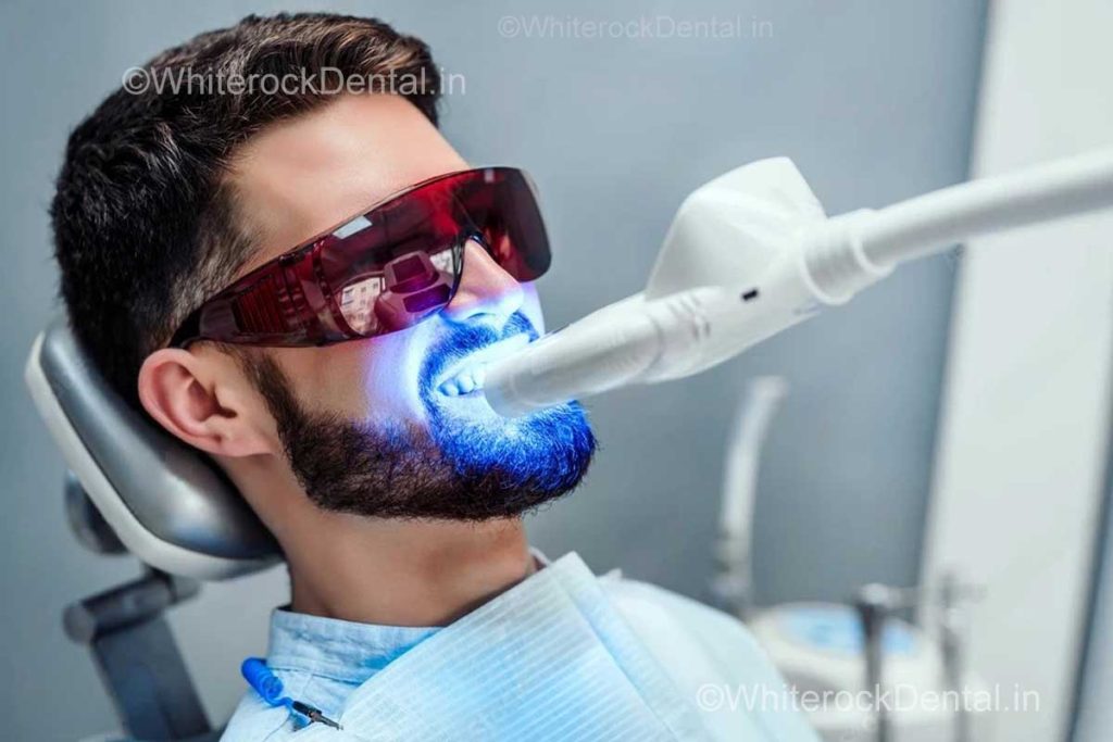 Pro whitening myths
