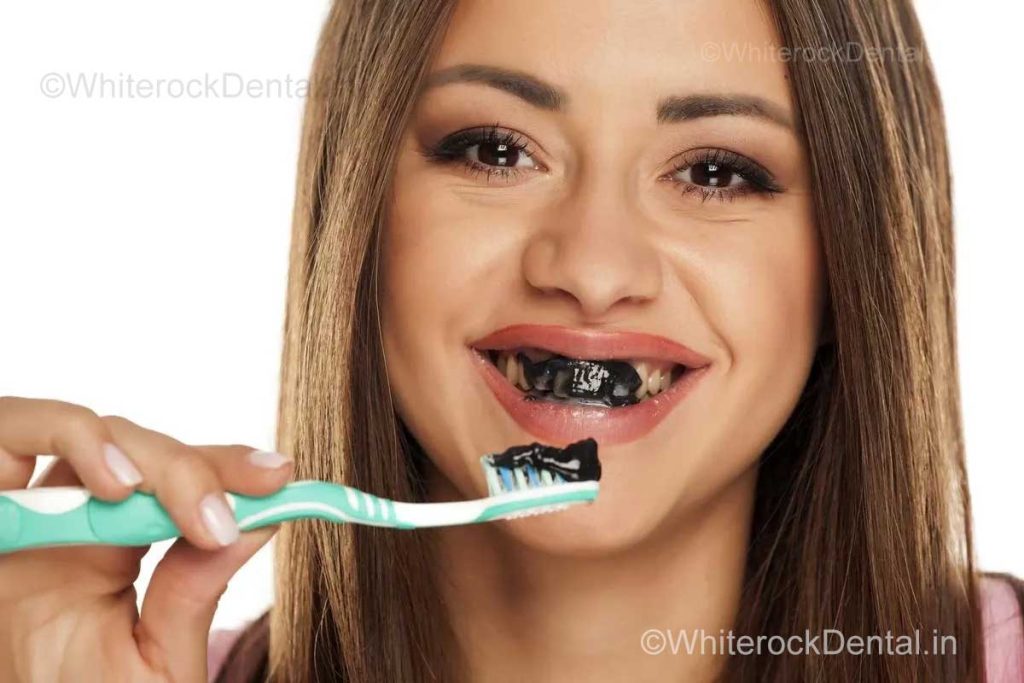 does toothpaste really whiten