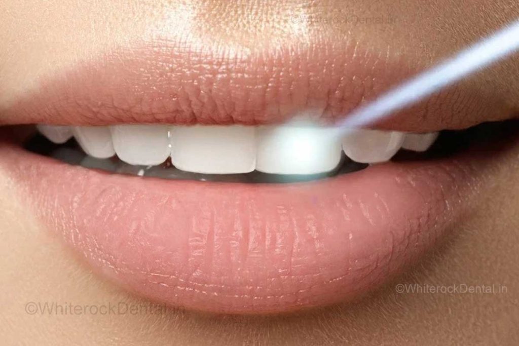 aftercare tips for whiter teeth