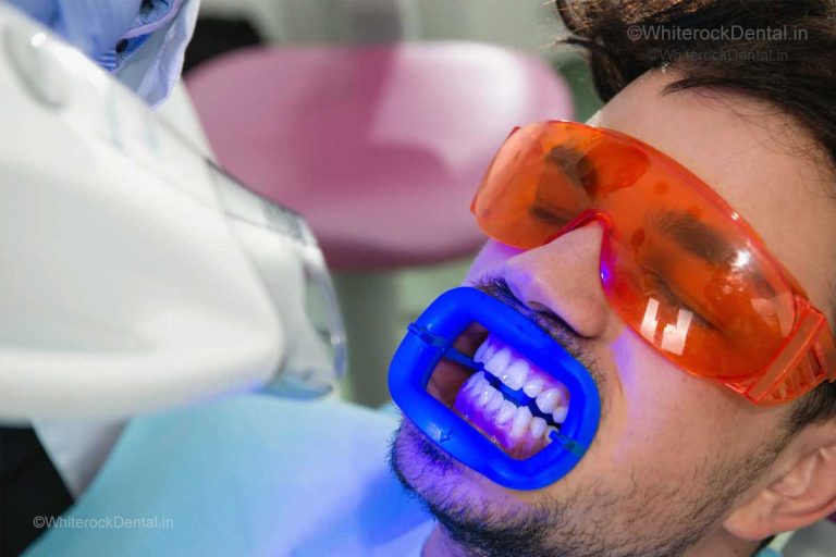 one-hour teeth whitening in Wadala